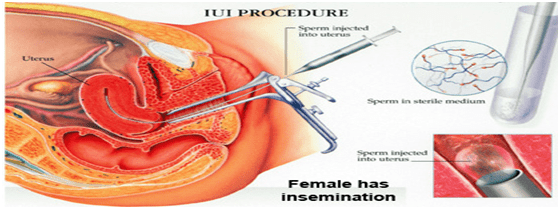 Infertility Clinic Shajrah
